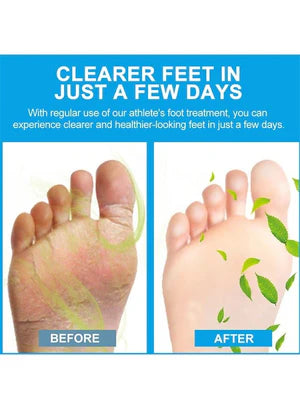 Sumifun Foot Protection Antibacterial Cream