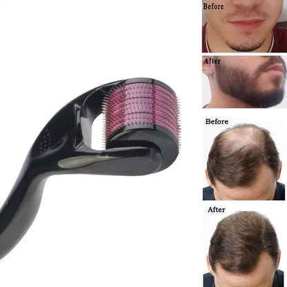 Derma Roller for Hair & Beard Growth – Microneedling Skin & Scalp Care Tool