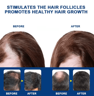 Sumifun - Hair Growth Cream 20G